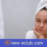 Łuszcząca się skóra twarzy