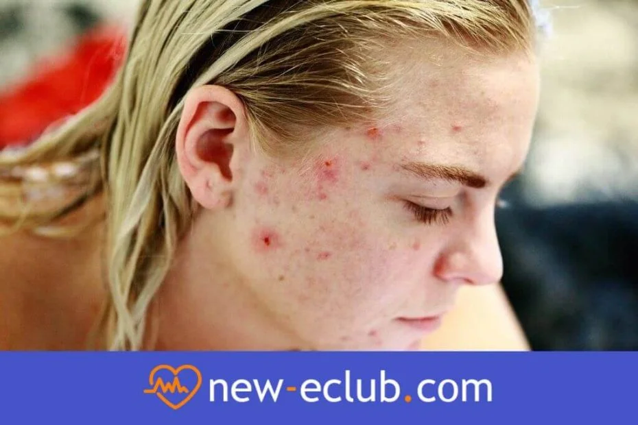 Podrażnienia skóry twarzy